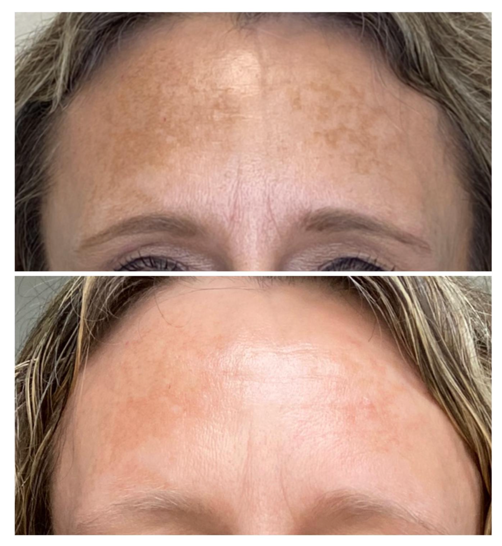 Cyspera INTENSIVE Pigment Correction | SOFIE PAVITT SKINCARE STUDIO